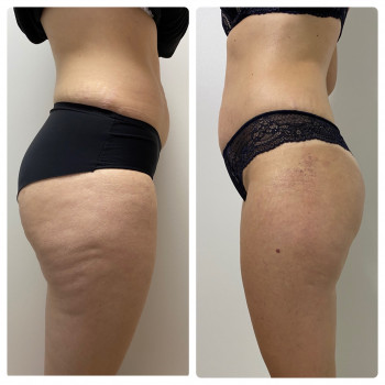 Kvitka Lotosa, Ирпень Фото - 31