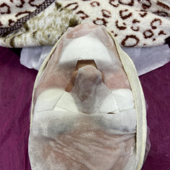 Карбокситерапия