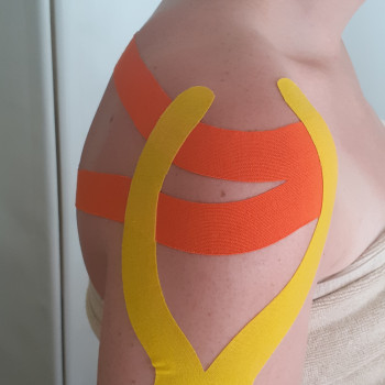 Олександр Дяченко, Кропивницький Фото - 8