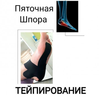 Олександр Дяченко, Кропивницький Фото - 17