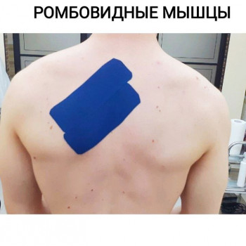 Олександр Дяченко, Кропивницький Фото - 19