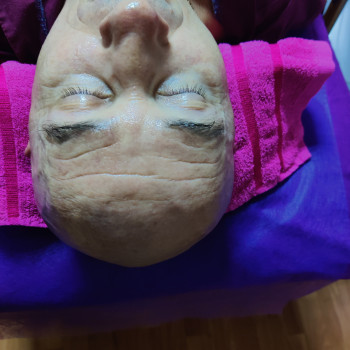 До процедуры