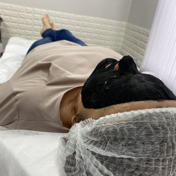 Карбоксітерапія