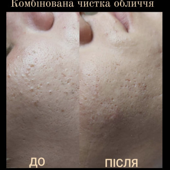 Олеся Грибан, Житомир Фото - 5