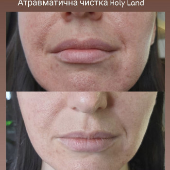 Олеся Грибан, Житомир Фото - 7