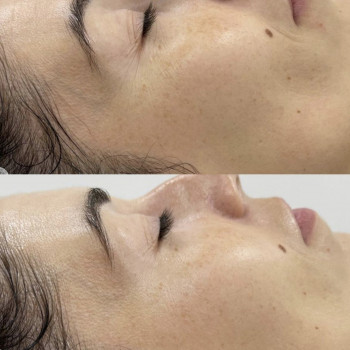 Олеся Грибан, Житомир Фото - 8