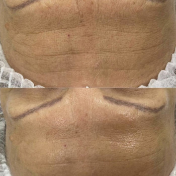 Олеся Грибан, Житомир Фото - 9