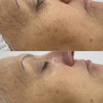 Олеся Грибан, Житомир Фото - 10