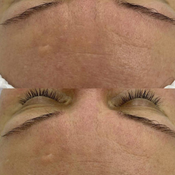 Олеся Грибан, Житомир Фото - 11