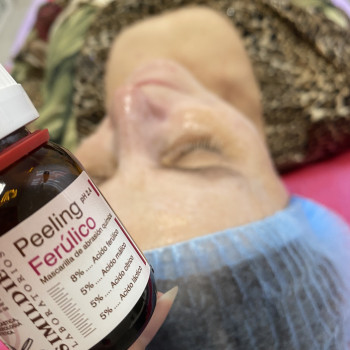 Пілінг феруловий