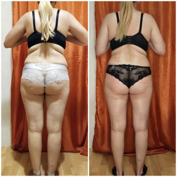 Моделирующий массаж - коррекция фигуры
                    Массажист Алена Киев