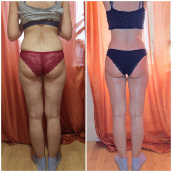 Моделирующий массаж - коррекция фигуры
                    Массажист Алена Киев