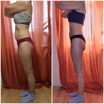 Моделирующий массаж - коррекция фигуры
                    Массажист Алена Киев