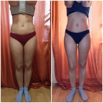 Моделирующий массаж - коррекция фигуры
                    Массажист Алена Киев