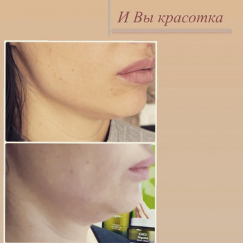 Наталья Еременко, Суми Фото - 16