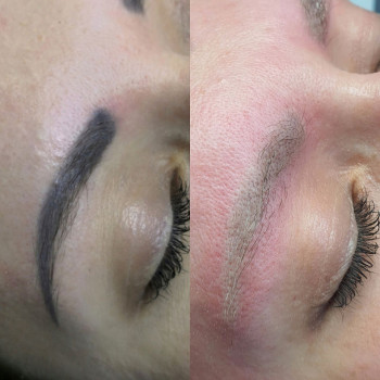 Видалення тату, фото - майстер перманентного макіяжу Ирина Лучистая