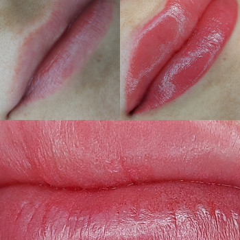 Губки до и после процедуры