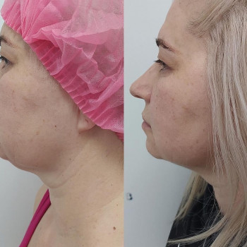 Инь Янь, Борисполь Фото - 8