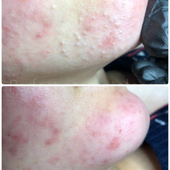 Ніка Асламович, Киев Фото - 5