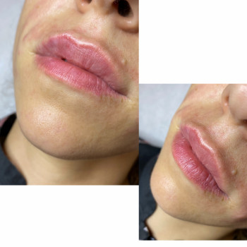 Марта Луців, Ивано-Франковск Фото - 5