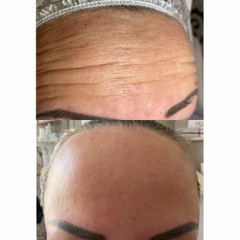 Марта Луців, Ивано-Франковск Фото - 6