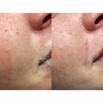 Марта Луців, Ивано-Франковск Фото - 8