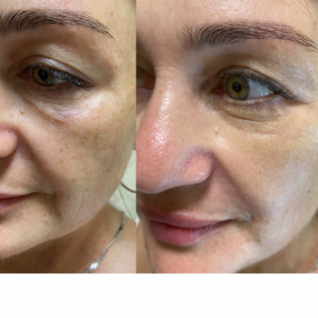 Марта Луців, Ивано-Франковск Фото - 9