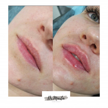 Марта Луців, Ивано-Франковск Фото - 10