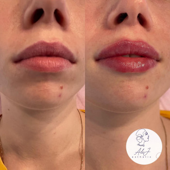 Юлия Тарапата, Київ Фото - 8