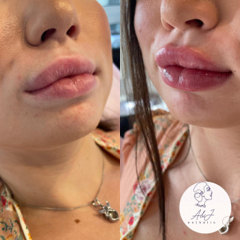 Юлия Тарапата, Київ Фото - 9