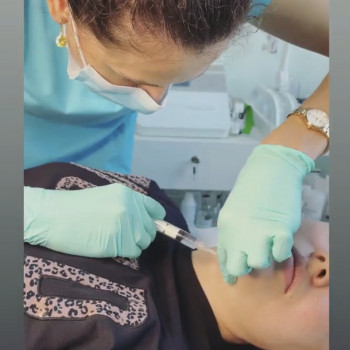 Борьба с жировыми отложениями нижней трети лица