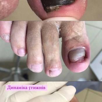 Динаміка 5 тижнів