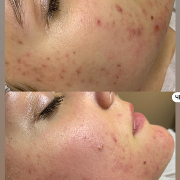 Олена Смульська, Хмельницький Фото - 34