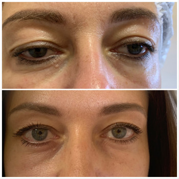 Олена Смульська, Хмельницький Фото - 35