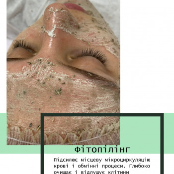 Олена Смульська, Хмельницький Фото - 36