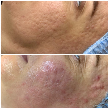 Олена Смульська, Хмельницький Фото - 38