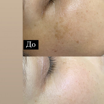 Олена Смульська, Хмельницький Фото - 39