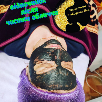 Чистка обличчя+маска