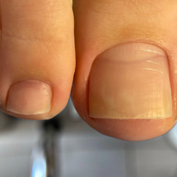 Аппаратный маникюр
                    Майстер манікюру Алена Одеса