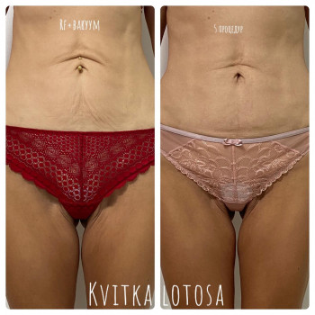 Kvitka Lotosa, Ирпень Фото - 9