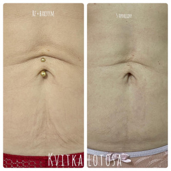 Kvitka Lotosa, Ирпень Фото - 4