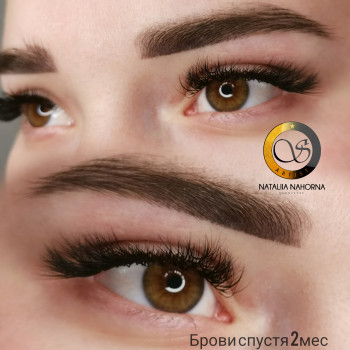 Зажившие брови