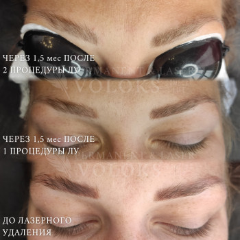 Промежуточные результаты удалений. Чистим дальше.