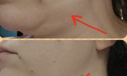 Массаж лица Мастер перманентного макияжа Диана Запорожье