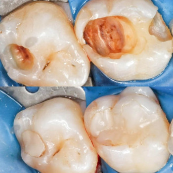 Андрей Шмыгленко, Київ Фото - 5