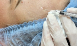 Ботокс Салон красоты NC Cosmetology Киев