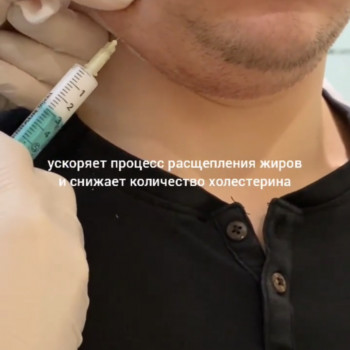 коррекция фигуры, уколы в лицо