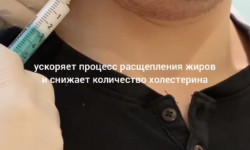 Липолитик DERMAHEAL LL Салон краси NC Cosmetology Київ