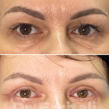 Абдель Эрритали, Харків Фото - 82