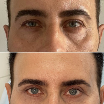 Абдель Эрритали, Харків Фото - 84